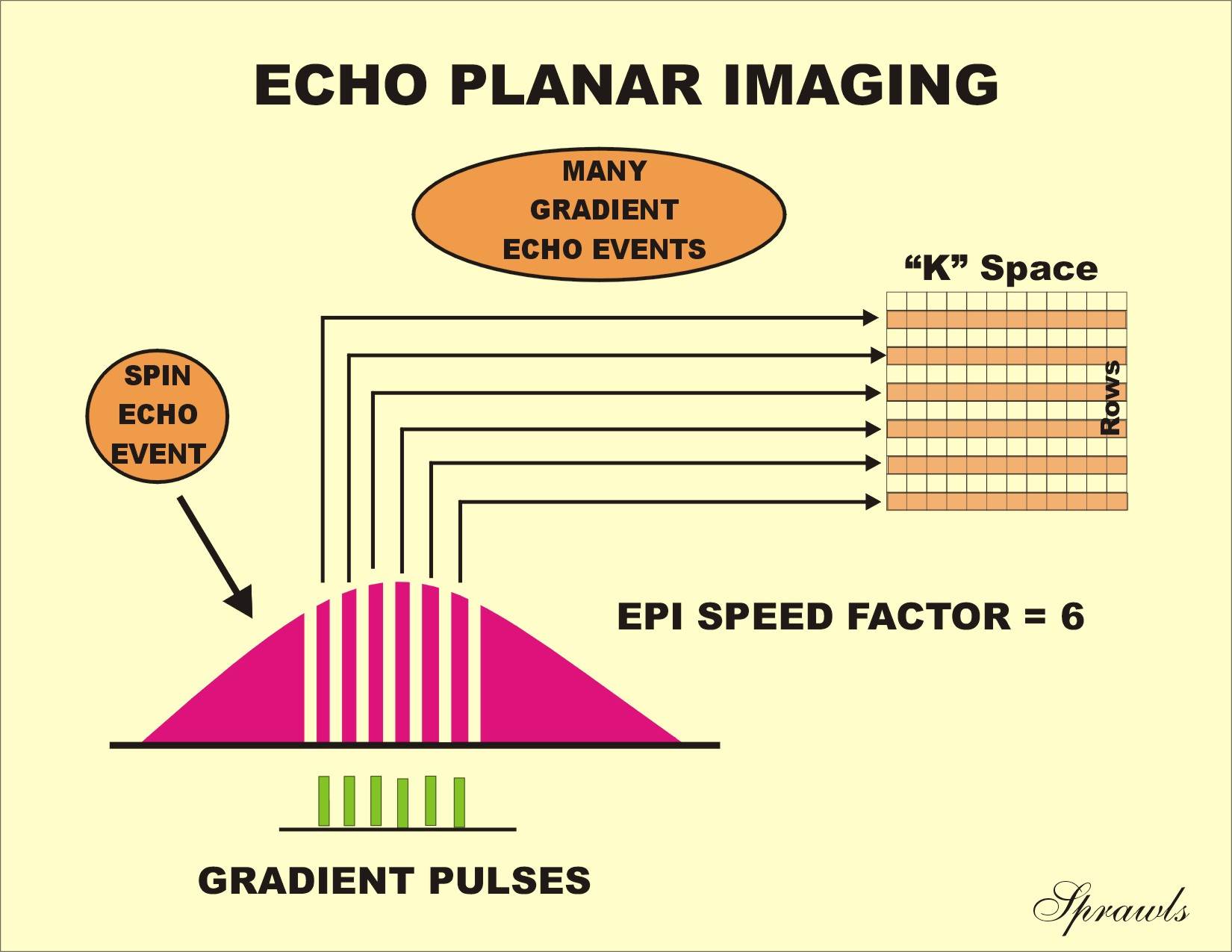 Mri Echo Planar Imaging Mr Tip Database vrogue.co
